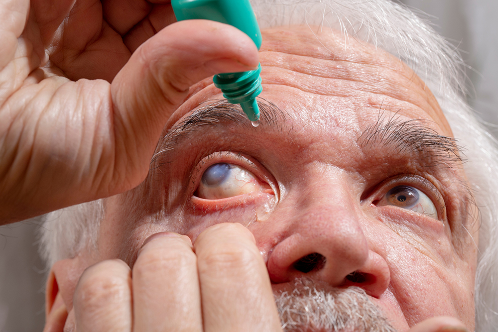 Glaucoma o que é causas tipos e tratamento Clínica de Olhos