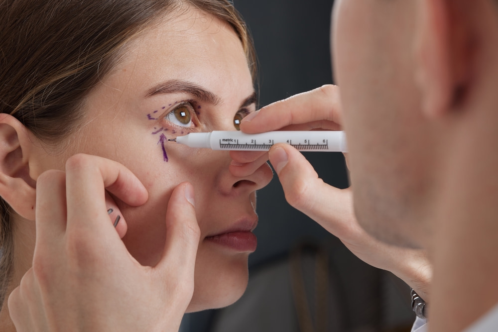 Qual é o preço da blefaroplastia em 2025?
