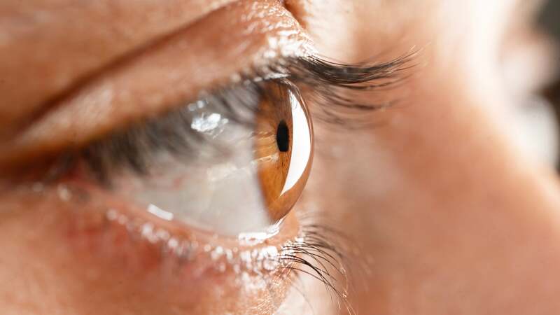Crosslinking corneano para ceratocone: como funciona?