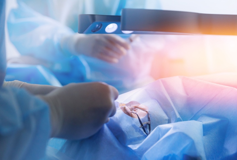 O que é cirurgia refrativa?
