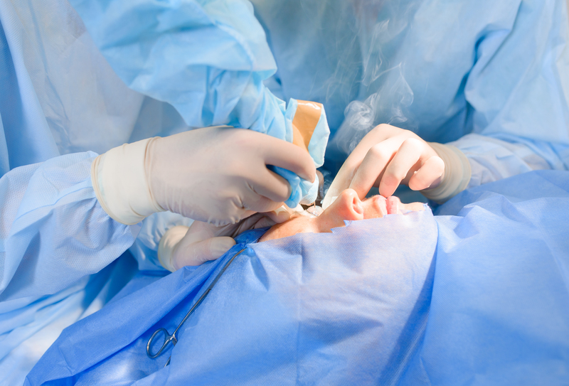 Blefaroplastia superior: como funciona? Qual o valor?